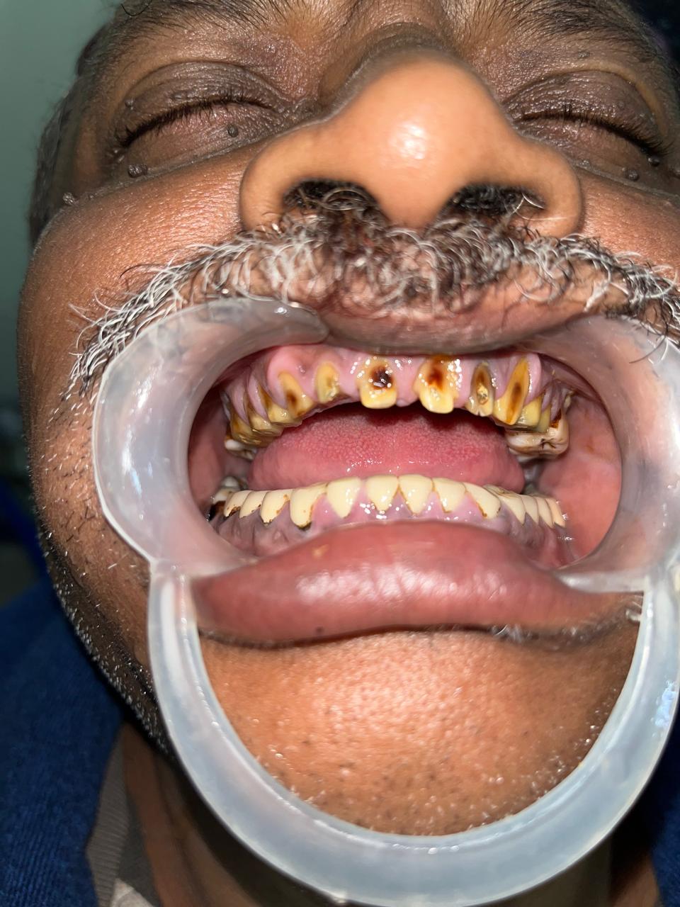 Advanced Dental Implant Technology