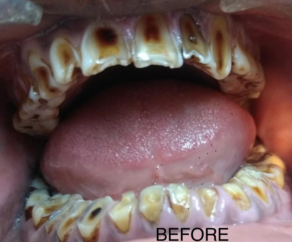 Our Dental Implant Specialist